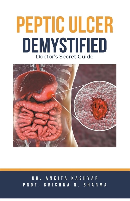 Peptic Ulcer Demystified: Doctors Secret Guide (Paperback)