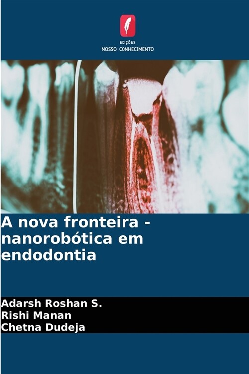 A nova fronteira - nanorob?ica em endodontia (Paperback)