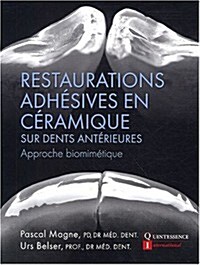 Restaurations Adh굎ives En C굍amique Sur Dents Ant굍ieures (Hardcover)