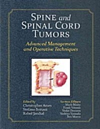 Spine and Spinal Cord Tumors: Advanced Management and Operative Techniques (Hardcover)