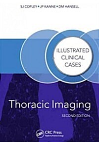 Thoracic Imaging: Illustrated Clinical Cases, Second Edition (Paperback, 2)