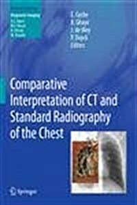 Comparative Interpretation of CT and Standard Radiography of the Chest (Paperback, 2011)