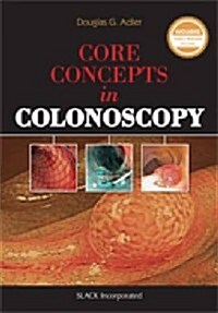 Core Concepts in Colonoscopy (Paperback)