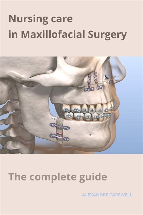 Nursing Care in Maxillofacial Surgery The complete Guide (Paperback)
