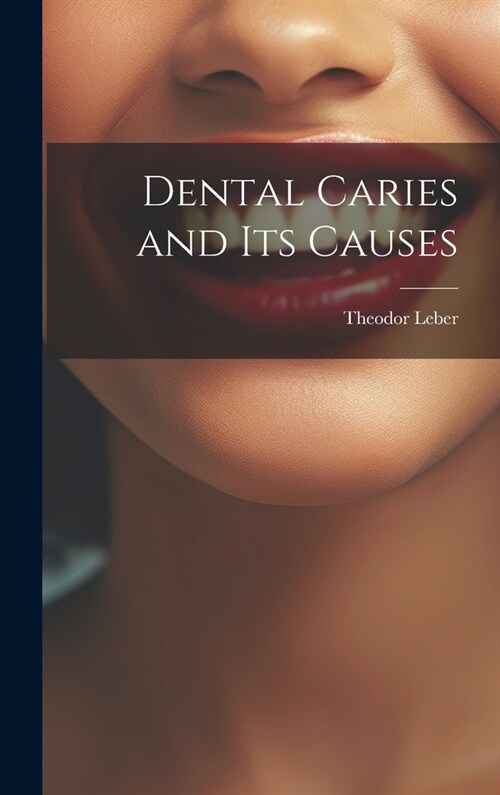 Dental Caries and Its Causes (Hardcover)