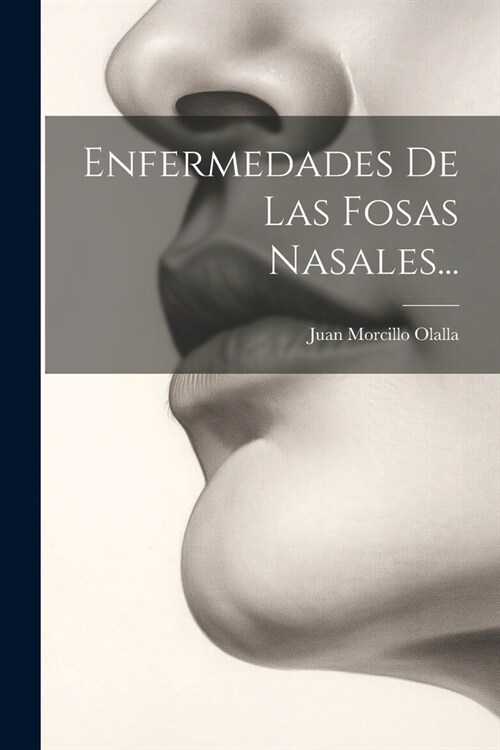Enfermedades De Las Fosas Nasales... (Paperback)