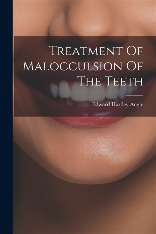Treatment Of Malocculsion Of The Teeth (Paperback)