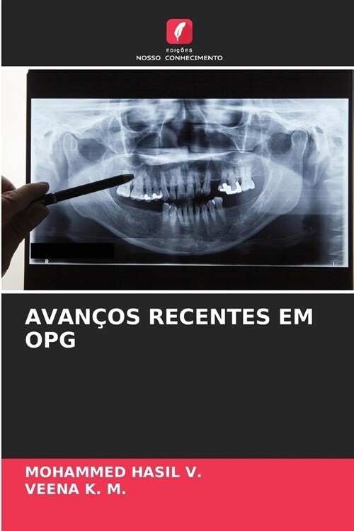 Avan?s Recentes Em Opg (Paperback)