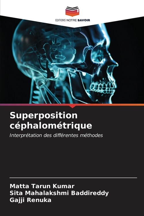 Superposition c?halom?rique (Paperback)