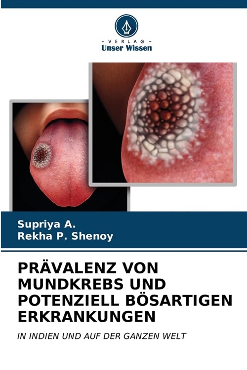 Pr?alenz Von Mundkrebs Und Potenziell B?artigen Erkrankungen (Paperback)