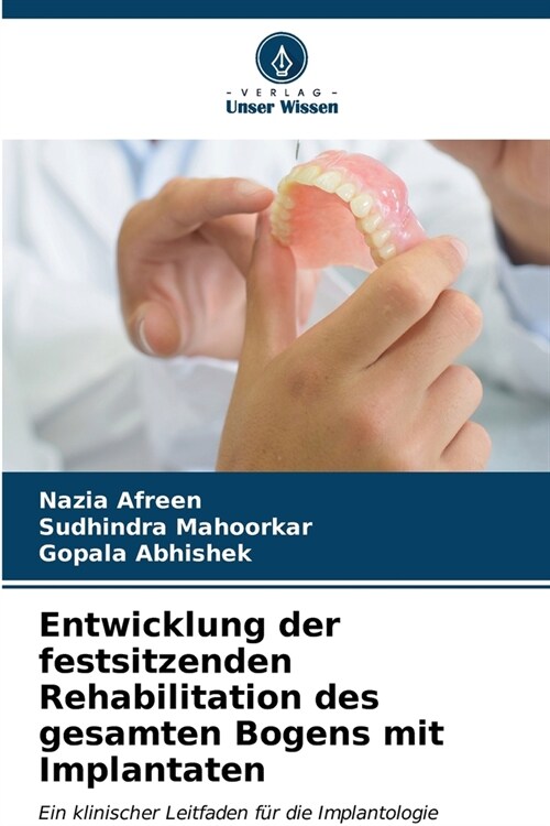 Entwicklung der festsitzenden Rehabilitation des gesamten Bogens mit Implantaten (Paperback)