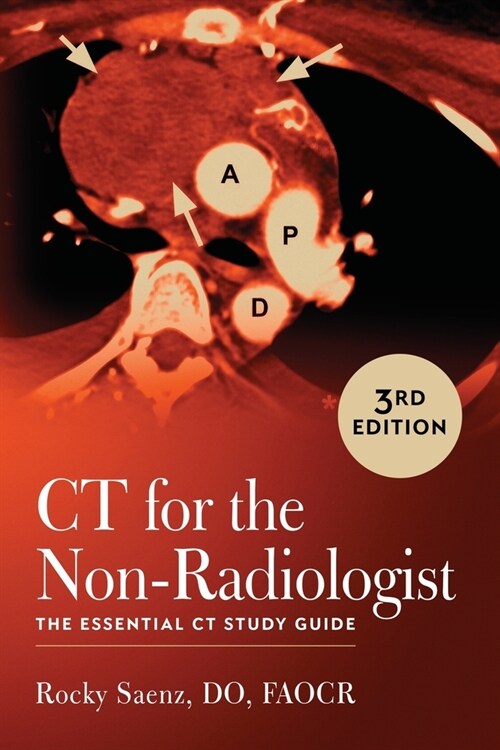 CT for the Non-Radiologist: The Essential CT Study Guide (3rd Edition) (Paperback, 3)
