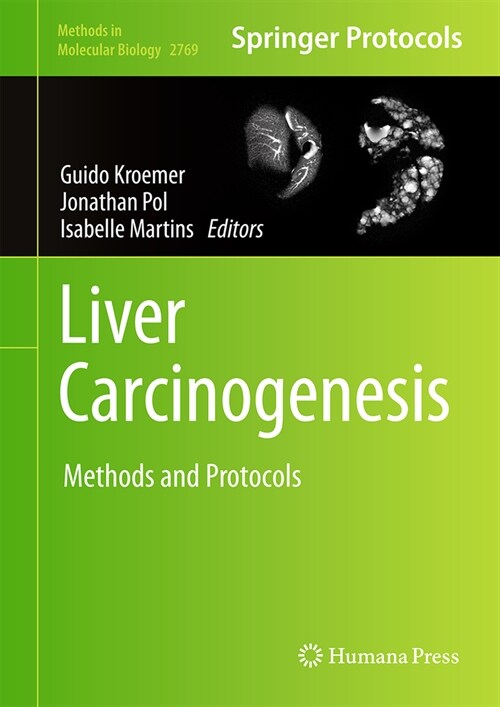 Liver Carcinogenesis: Methods and Protocols (Hardcover, 2024)