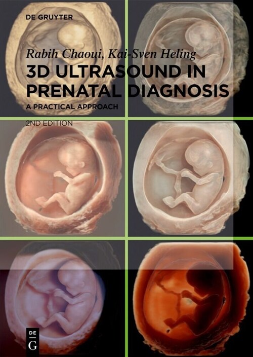 3D Ultrasound in Prenatal Diagnosis: A Practical Approach (Hardcover, 2)