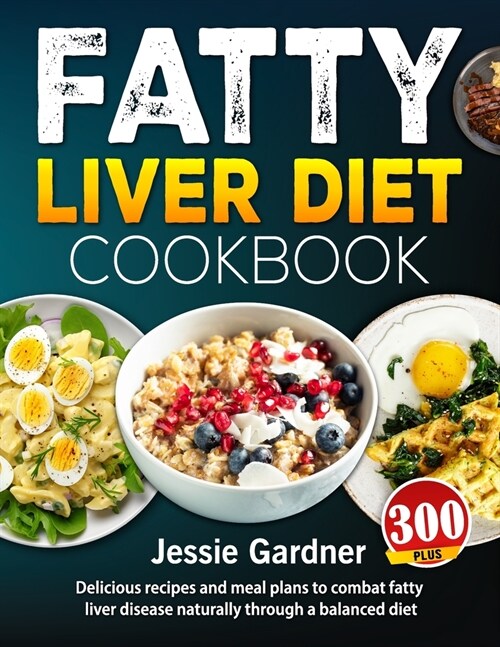 Fatty Liver Diet Cookbook: 300+ delicious recipes and meal plans to combat fatty liver disease naturally through a balanced diet (Paperback)