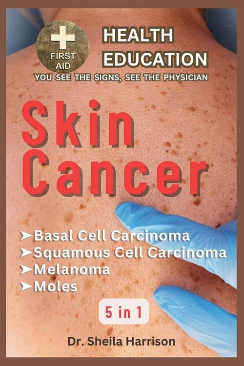 Skin Cancer: Basal Cell Carcinoma, Squamous Cell Carcinoma, Melanoma Skin Cancer, Mole: Types, Symptoms, Causes, Diagnosis, Treatme (Paperback)