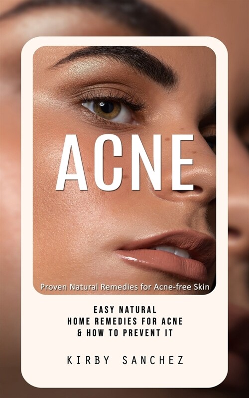 Acne: Proven Natural Remedies for Acne-free Skin (Easy Natural Home Remedies for Acne & How to Prevent It) (Paperback)