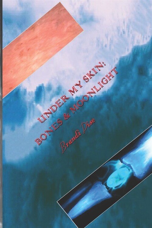 Under My Skin: Bones and Moonlight (Paperback)