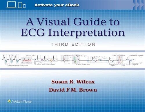 A Visual Guide to ECG Interpretation: Print + eBook with Multimedia (Paperback, 3)