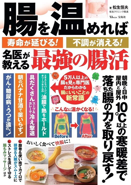 腸を溫めれば壽命が延びる!不調が消える! 名醫が敎える最强の腸活 (TJMOOK)