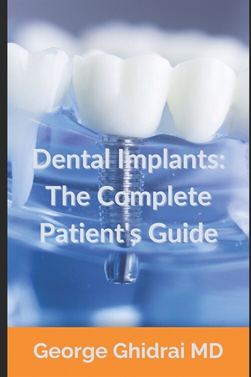 Dental Implants: The Complete Patients Guide (Paperback)