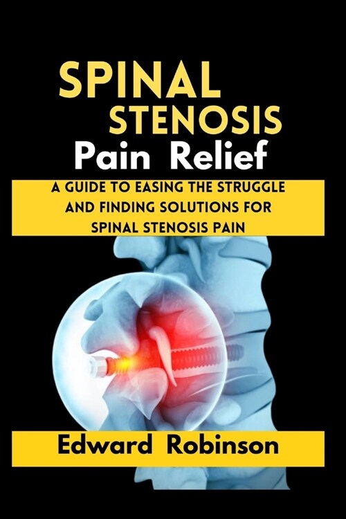 Spinal Stenosis Pain Relief: A guide to Easing the struggle And Finding Solutions For Spinal Stenosis Pain (Paperback)