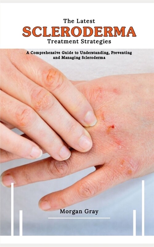 The Latest Scleroderma Treatment Strategies: A Comprehensive Guide to Understanding, Preventing and Managing Scleroderma (Paperback)