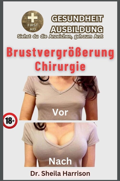 Brustvergr秤erung Chirurgie: Essenz einer Operation, Vorteile, Nachteile, Gebote und Verbote, Vorbereitung auf die Operation, Operationsverfahren, (Paperback)