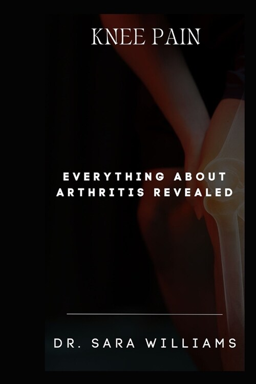 Knee Pain: Everything about Arthritis Revealed (Paperback)