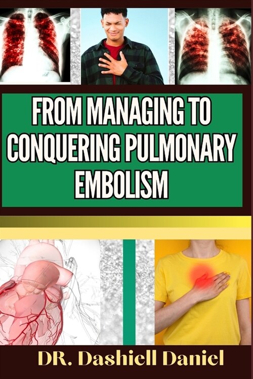 From Managing to Conquering Pulmonary Embolism: Expert Guide To Understanding the Causes, Recognizing Symptoms, Prevention and Embracing Effective Tre (Paperback)