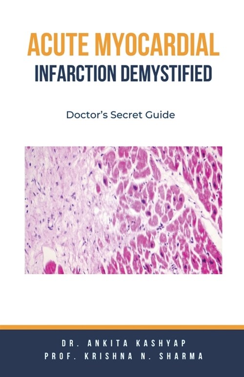 Acute Myocardial Infarction Demystified: Doctors Secret Guide (Paperback)