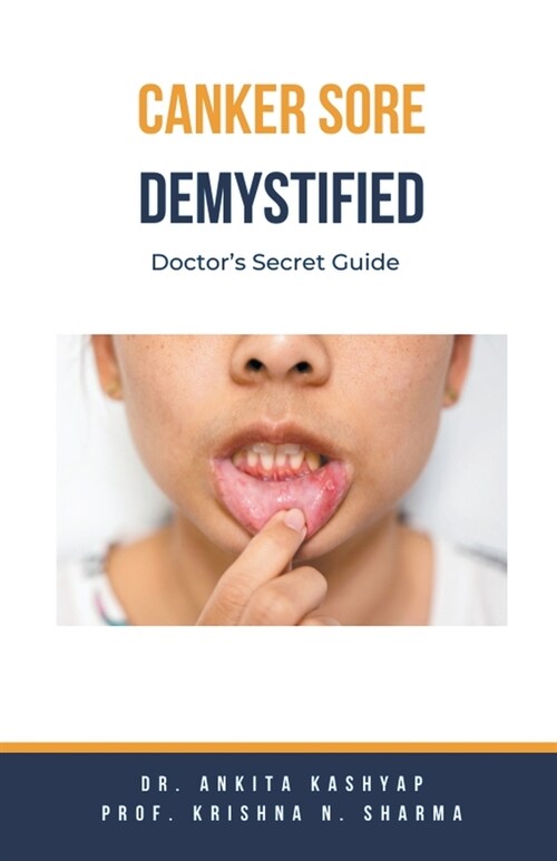 Canker Sore Demystified: Doctors Secret Guide (Paperback)