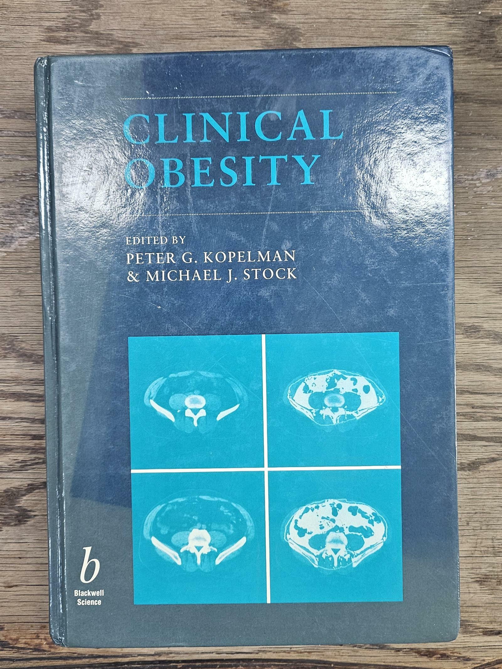 [중고] Clinical Obesity (Hardcover)