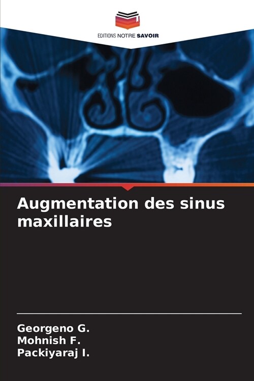 Augmentation des sinus maxillaires (Paperback)