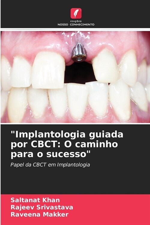 Implantologia guiada por CBCT: O caminho para o sucesso (Paperback)