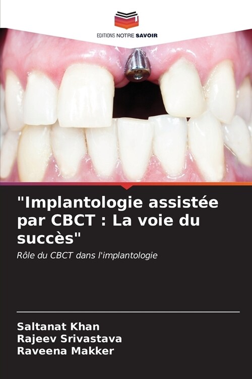 Implantologie assist? par CBCT: La voie du succ? (Paperback)