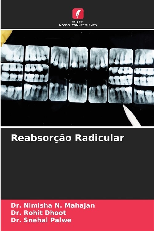 Reabsor豫o Radicular (Paperback)