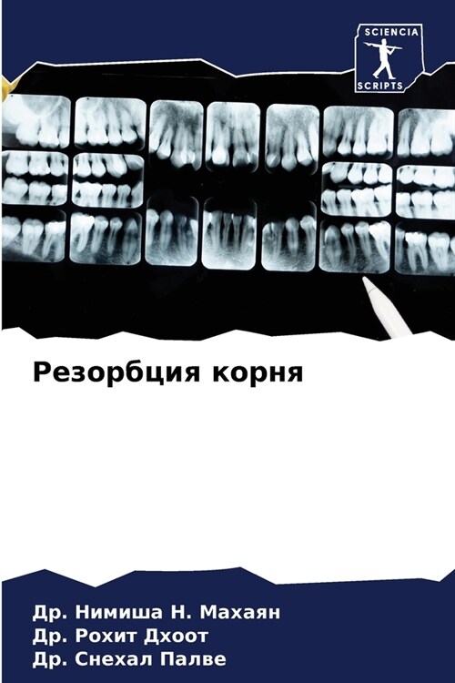 Резорбция корня (Paperback)