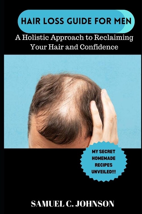 Hairloss Guide for Men: A Holistic Approach To Reclaiming Your Hair and Confidence. With My Secret Natural Home-Made Remedies for Hairloss Unv (Paperback)