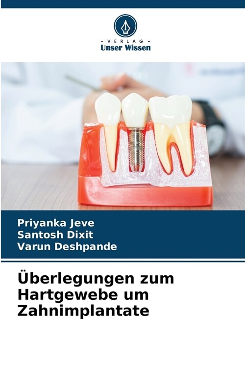 ?erlegungen zum Hartgewebe um Zahnimplantate (Paperback)