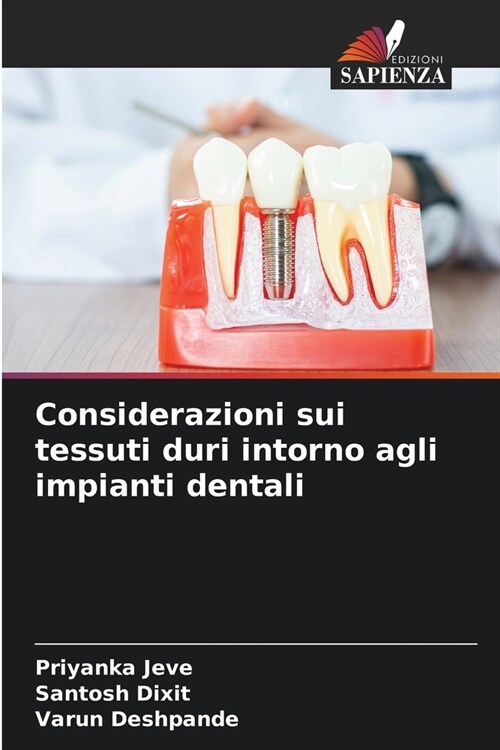 Considerazioni sui tessuti duri intorno agli impianti dentali (Paperback)
