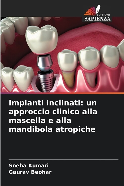 Impianti inclinati: un approccio clinico alla mascella e alla mandibola atropiche (Paperback)