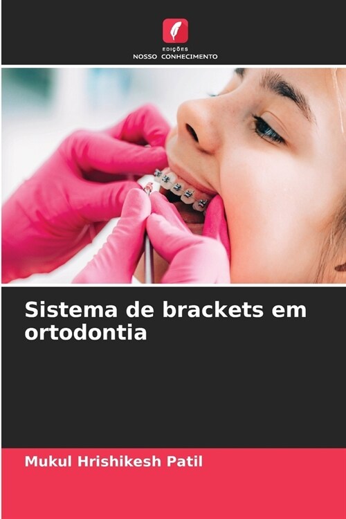 Sistema de brackets em ortodontia (Paperback)