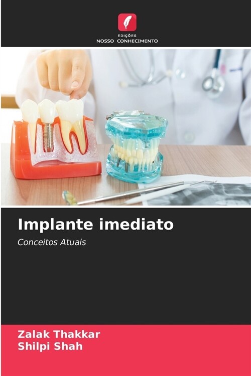 Implante imediato (Paperback)