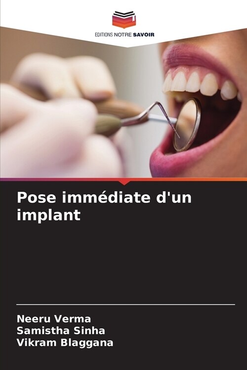 Pose imm?iate dun implant (Paperback)