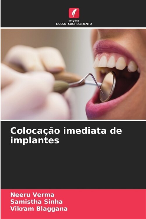 Coloca豫o imediata de implantes (Paperback)