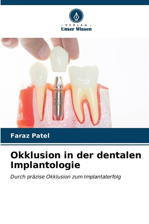 Okklusion in der dentalen Implantologie (Paperback)
