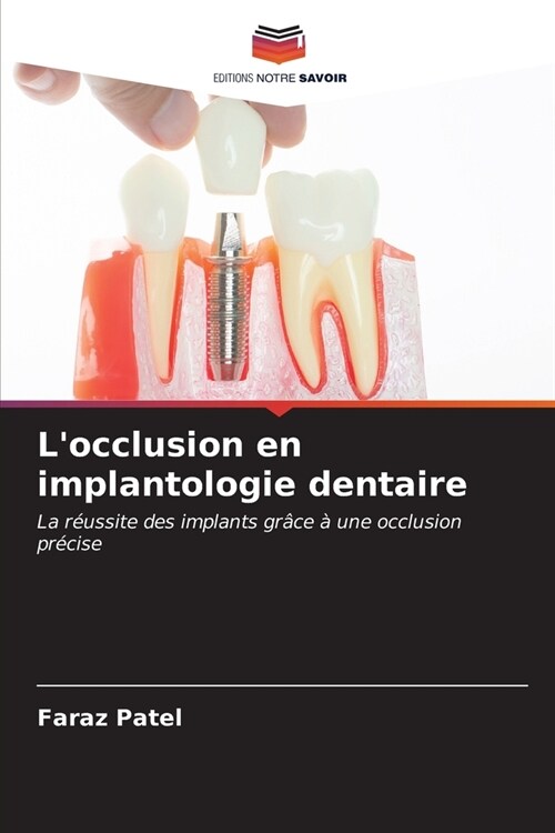 Locclusion en implantologie dentaire (Paperback)