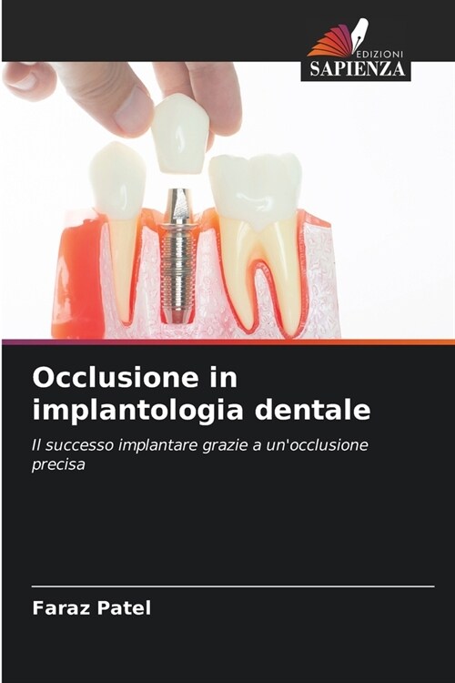 Occlusione in implantologia dentale (Paperback)