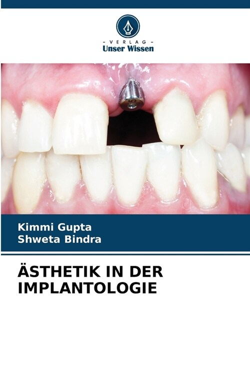훥thetik in Der Implantologie (Paperback)